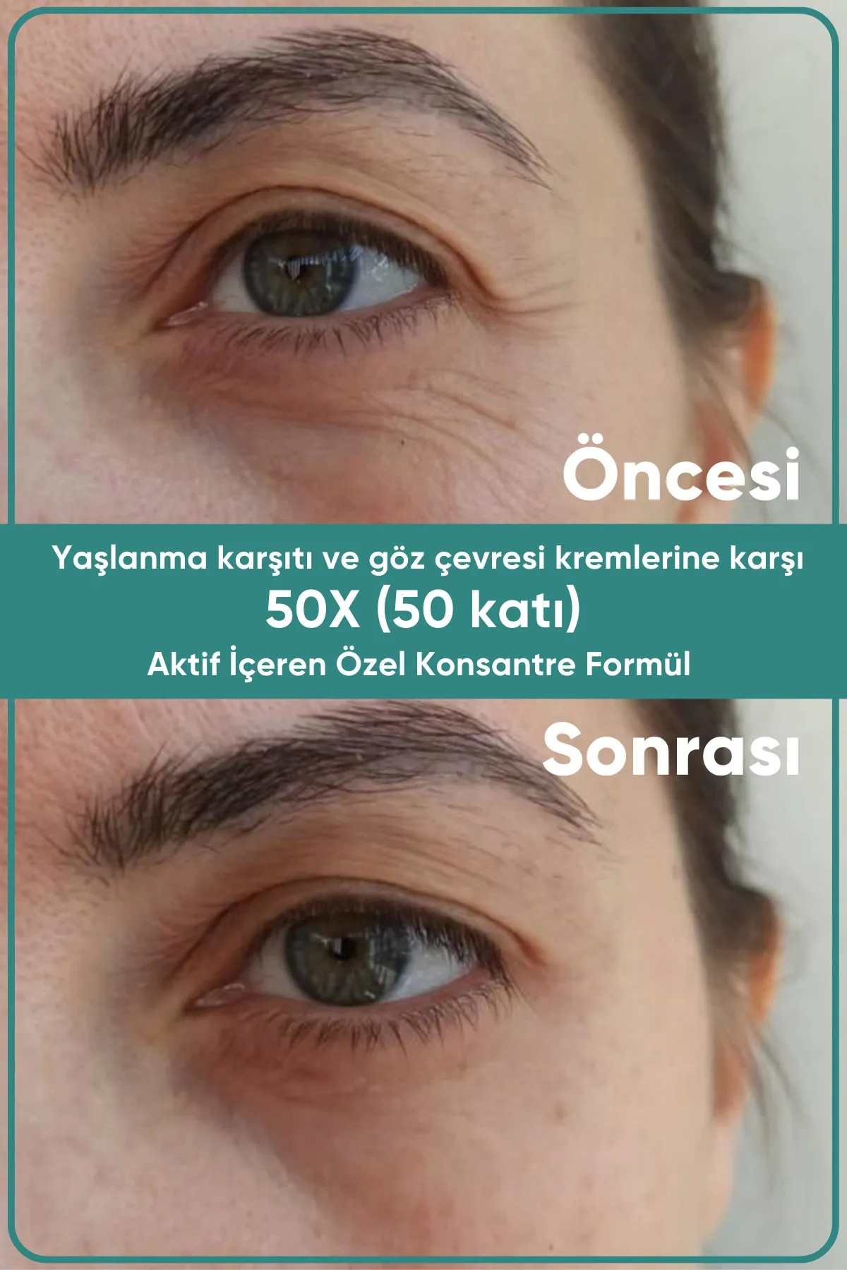 Yeşilmarka Triple Effect Krem - Thumbnail